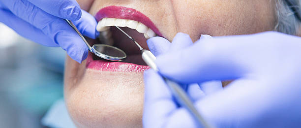 Best Emergency Treatment for Toothache in Pioneer, CA