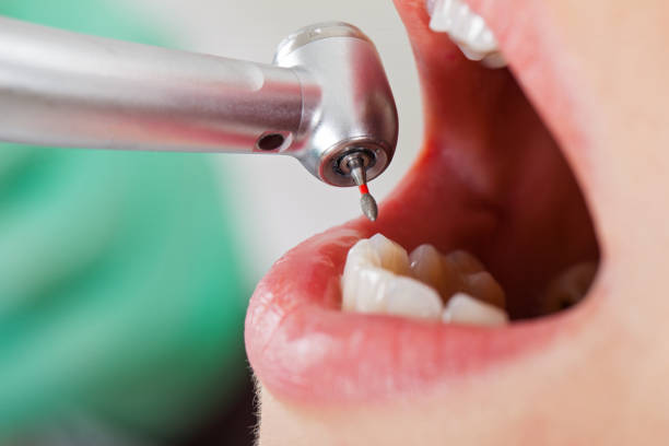 Best Emergency Orthodontic Repairs in Pioneer, CA